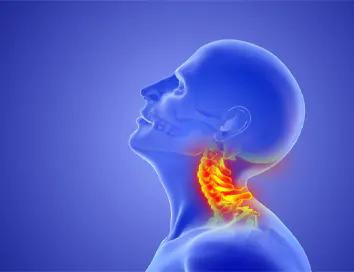 Sindromul Whiplash: O leziune invizibilă cu consecințe vizibile