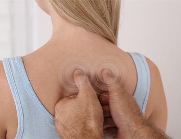 Trigger points sau punctele de declanșare